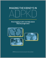 ADPKD Imaging Leave Behind Thumbnail