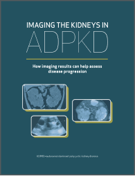 ADPKD imaging brochure thumbnail