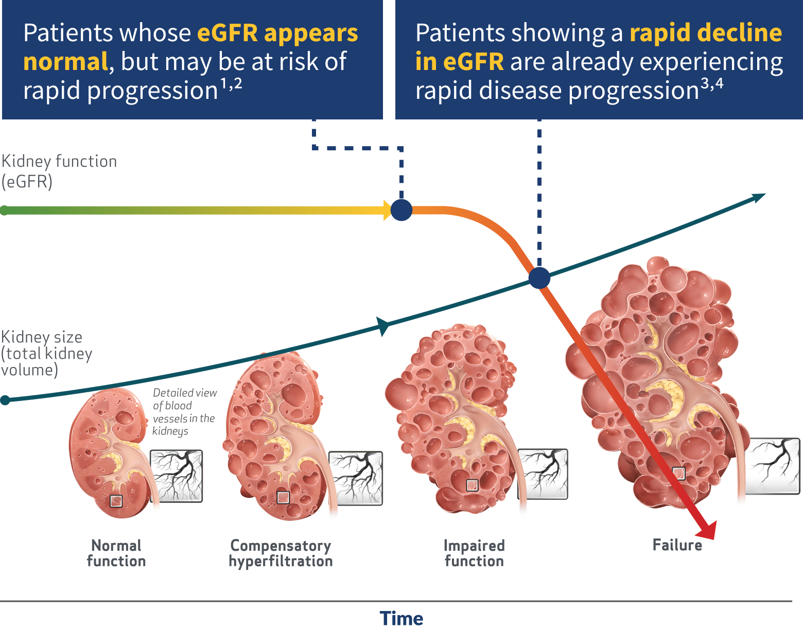 Stable eGFR vs. Rapidly Declining eGFR, Graph