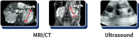 MRI/CT & Ultrasound Images