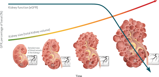 Kidney Function and TKV Over Time