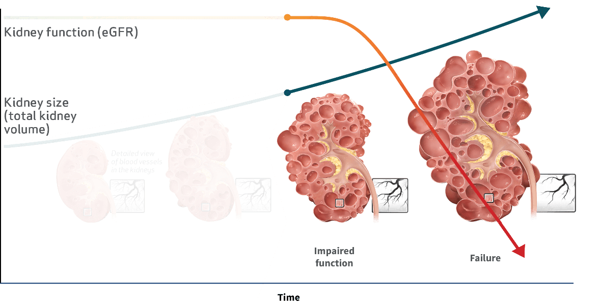 Kidney Function vs. Kidney Size Over Time, Graph