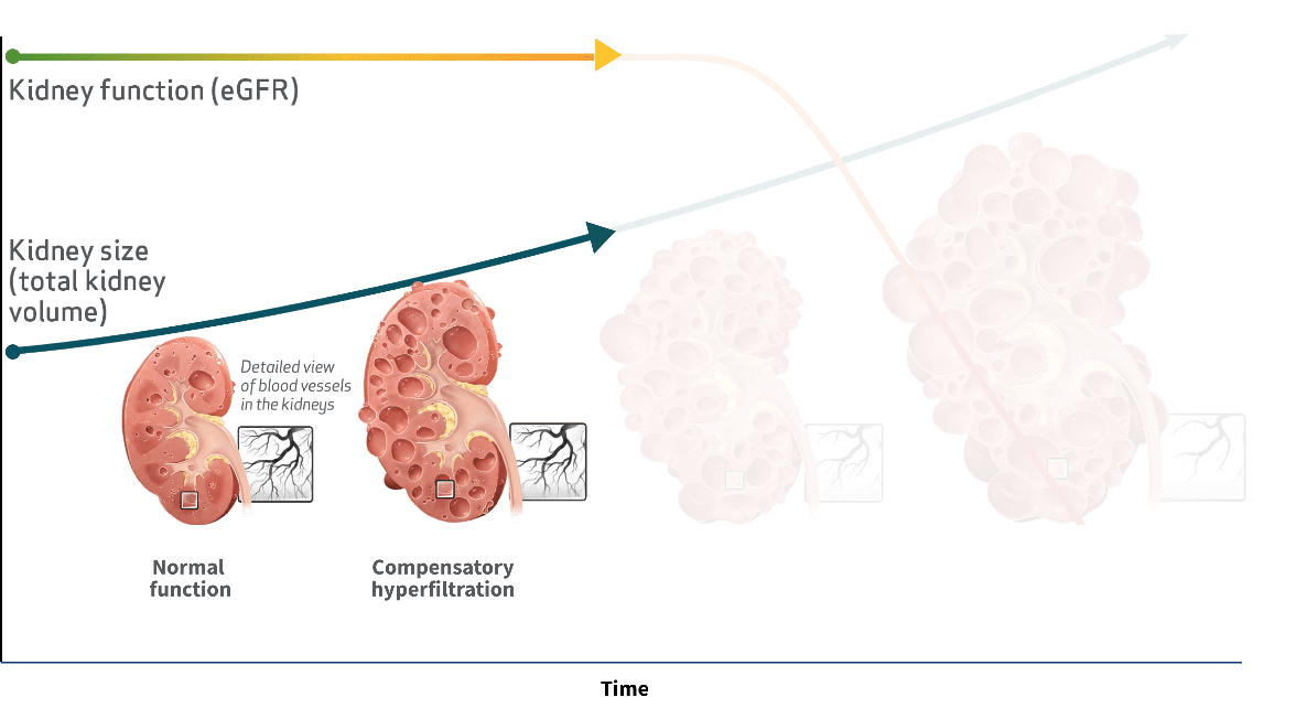 Kidney Function vs. Kidney Size Over Time, Graph