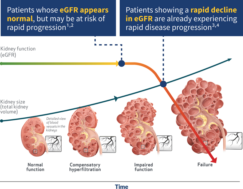 Stable eGFR vs. Rapidly Declining eGFR, Graph