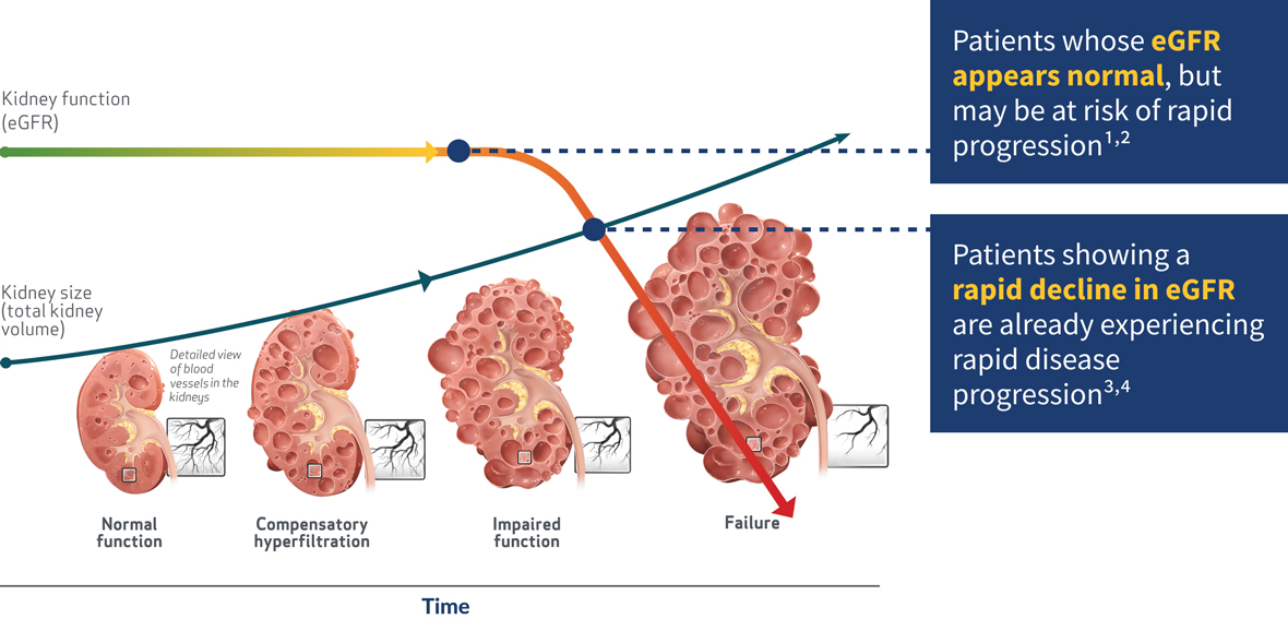 Stable eGFR vs. Rapidly Declining eGFR, Graph
