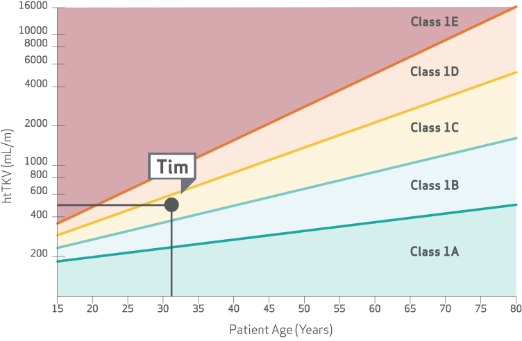 htTKV Class, Tim’s Chart