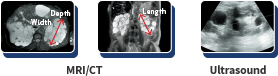 MRI/CT & Ultrasound Images
