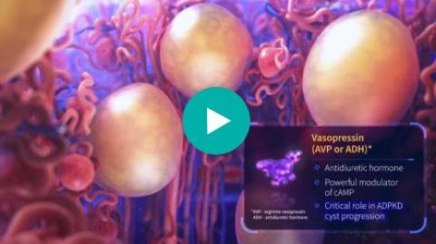 Role of Vasopressin in ADPKD Progression, Video